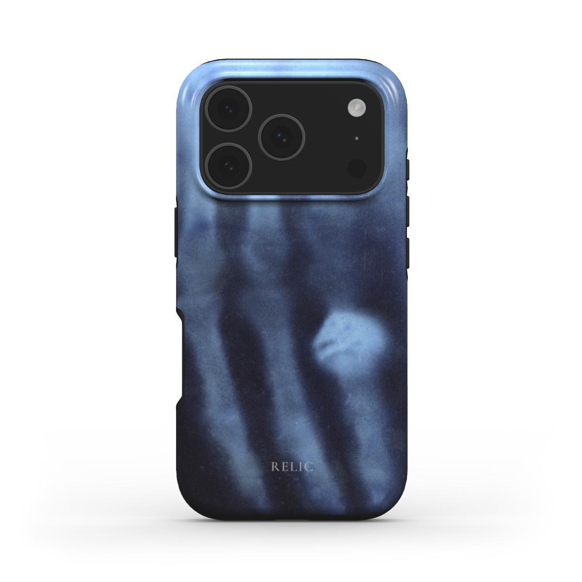 X-Ray Genesis MagSafe